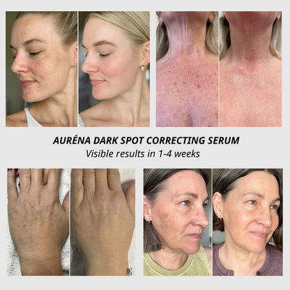Auréna Dark Spot Correcting Serum